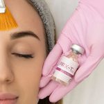 non-peeling-peel-prx-dermperfexion-treatment