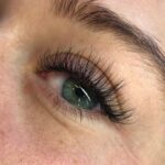 Augnháralenging - Hybrid