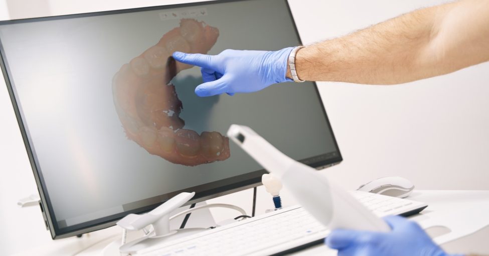 Person pointing and assessing a digital image of teeth on a monitor