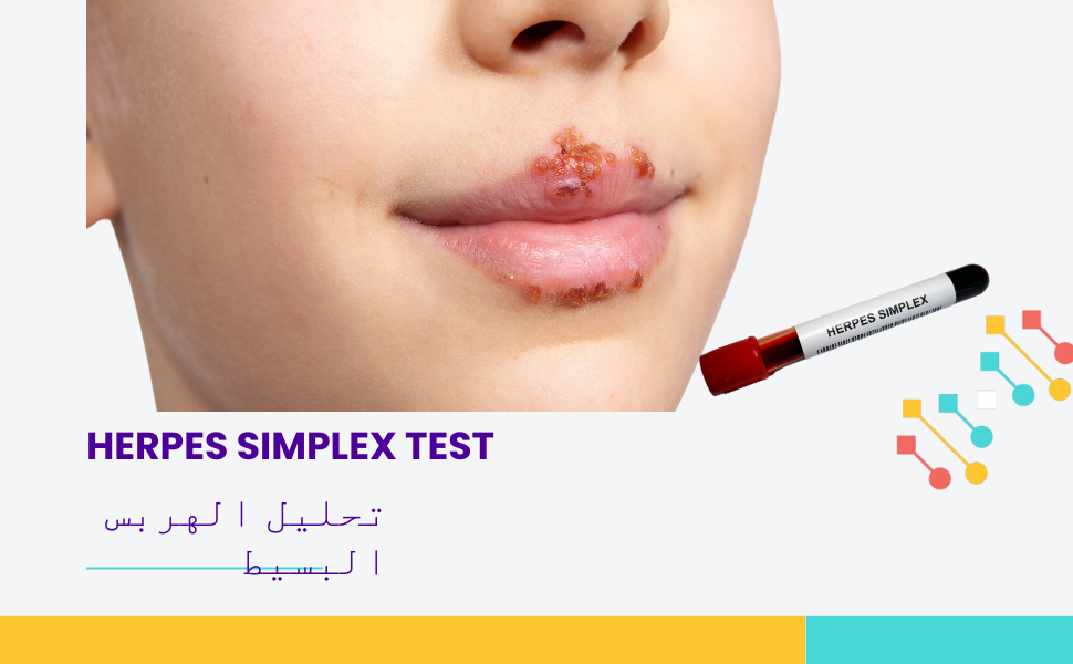 Test