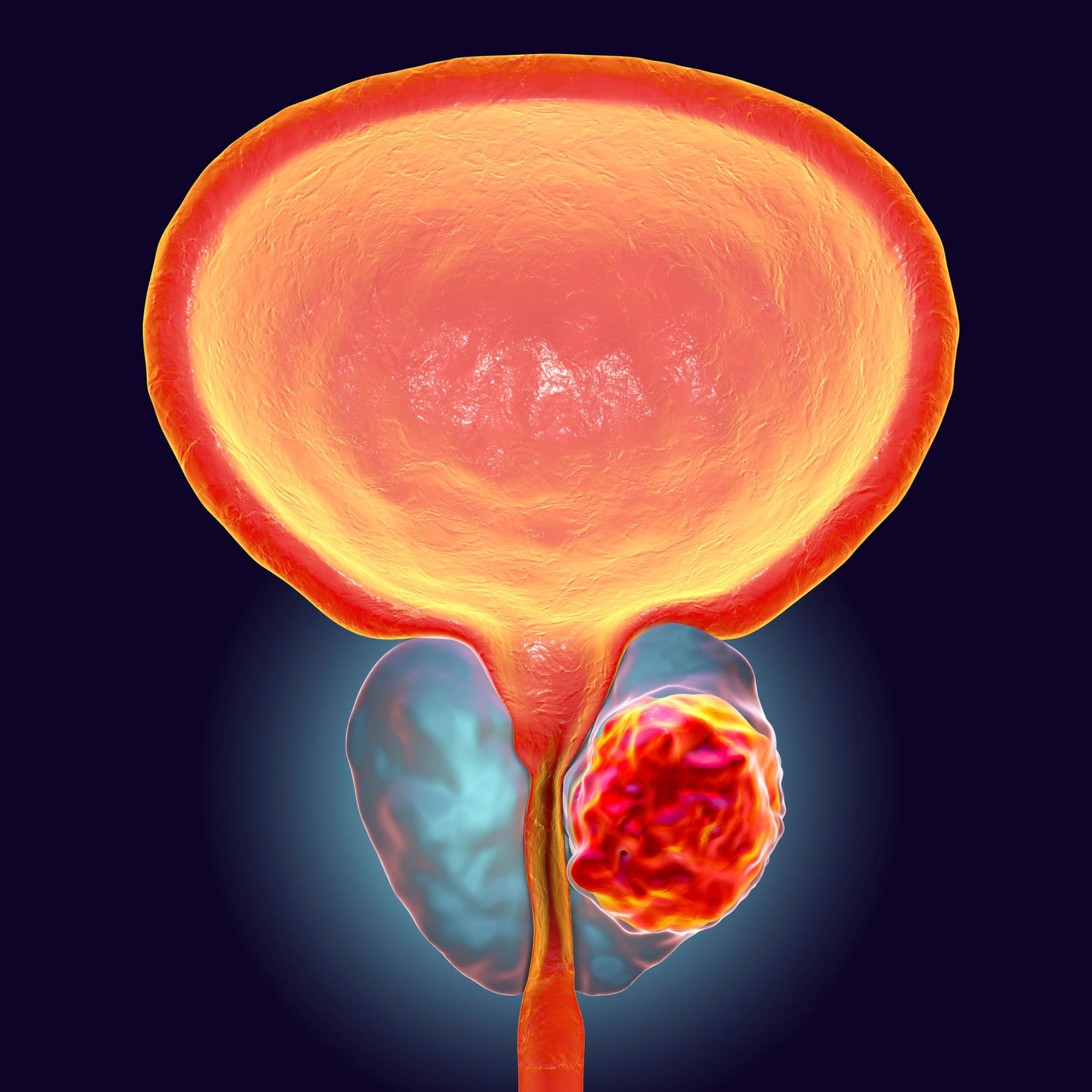 Package Image