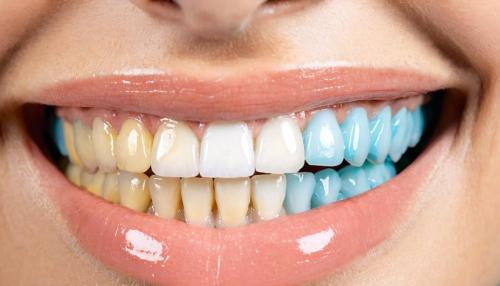 La revolución silenciosa en tu boca: cómo la salud dental está cambiando más allá de las caries