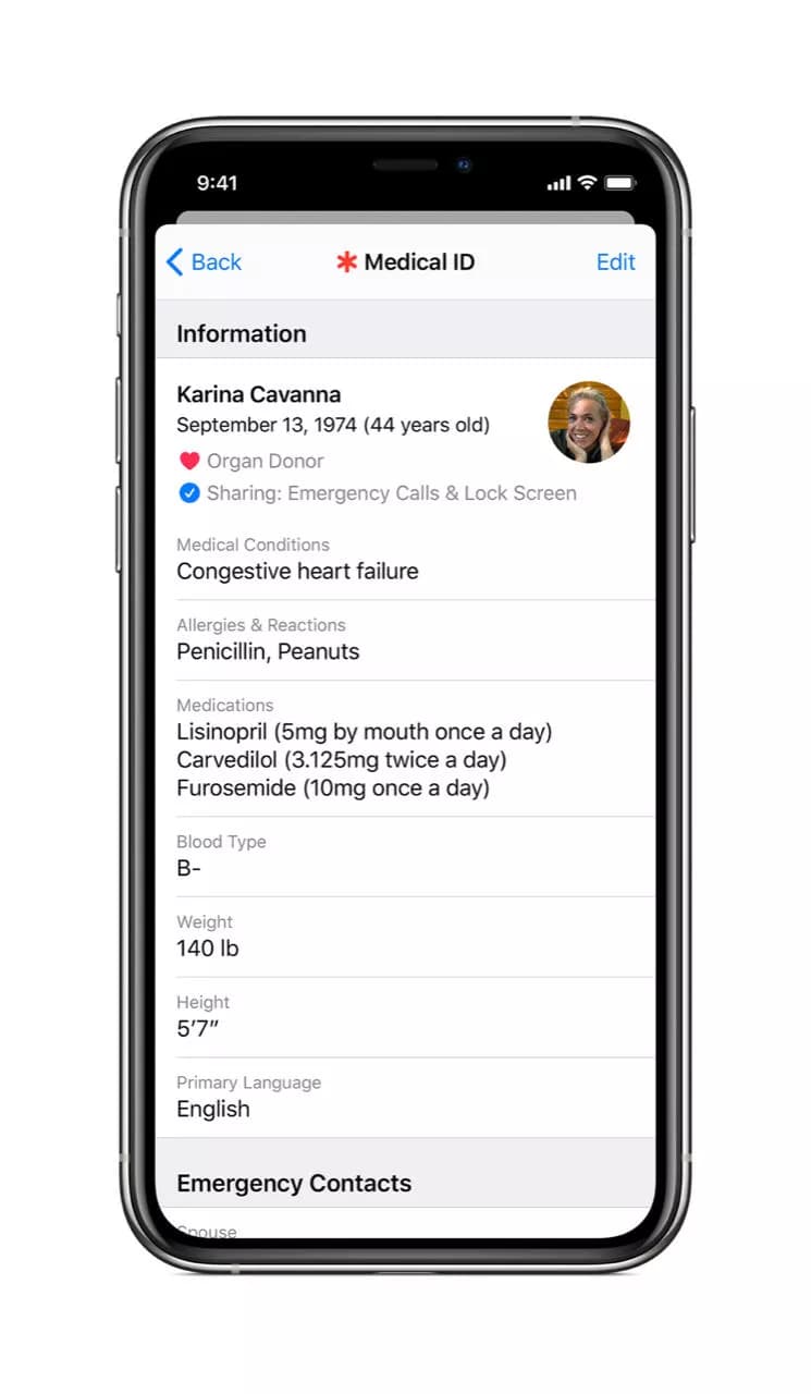 تحديث iOS 13.5 ومشاركة بيانات Medical ID
