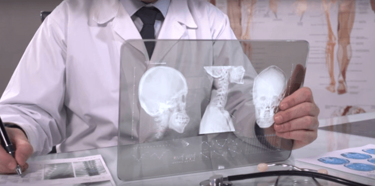 هل تستطيع IBM القضاء على السرطان بنظامها واتسون؟