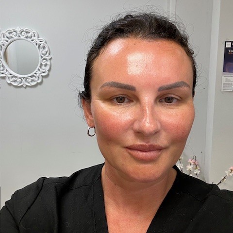 commonly asked questions about botox treatments
