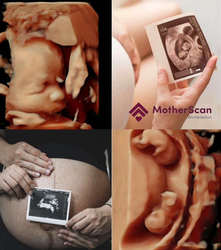 private ultrasound clinic south west london 
