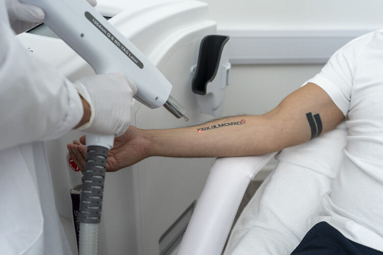 LASER TREATMENTS