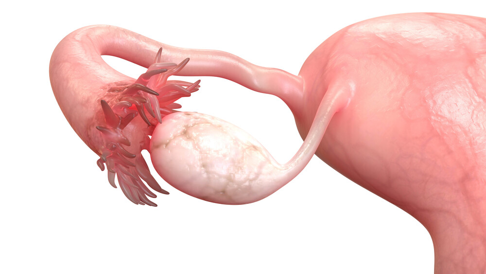 Tubal surgeries