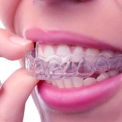 Clear Invisalign Teeth Straightening At Eyes & Smiles Dental Clinic in Finchley North London N11, aligners, retainer, removable, invisible, straight teeth, crowding, crooked, gaps, overbite, cross bite, open bite, teeth stick out, ABC,