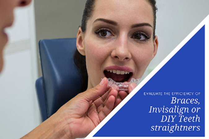 Evaluate The Efficiency Of Braces, Invisalign Or DIY Teeth Straighteners