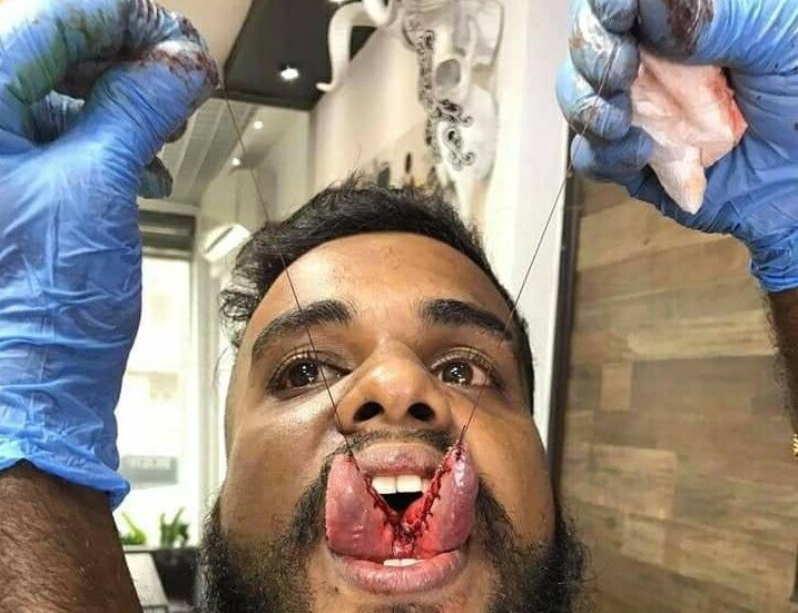 ஸ்ரைல் மோகத்தில் நாக்கை இரண்டாகப் பிளந்த இளைஞர்