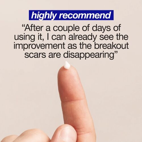 Clear Start Post-Breakout Fix