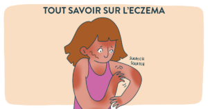 tout savoir sur l'eczéma
