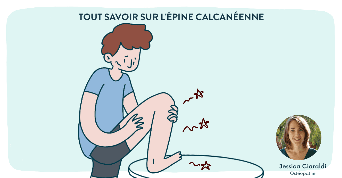 Douleur au talon : tout savoir sur l’épine calcanéenne