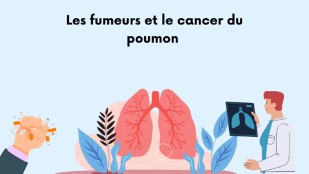Cancer du poumon chez le fumeur : risques, symptômes et prévention