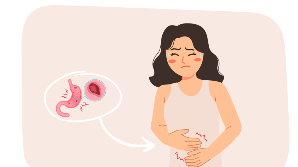 Virus hiver Gastro-entérite : comment la soigner