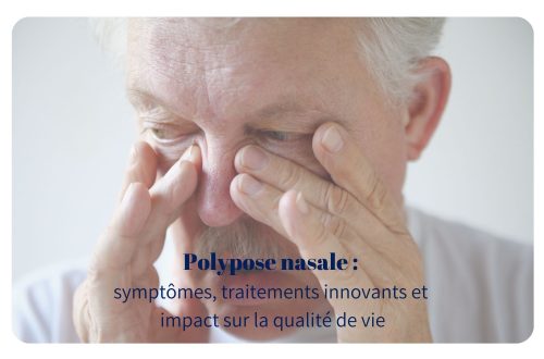 Découvrez tout sur la polypose nasale : symptômes, traitements innovants comme les biothérapies, et conseils pour améliorer votre qualité de vie du patient.