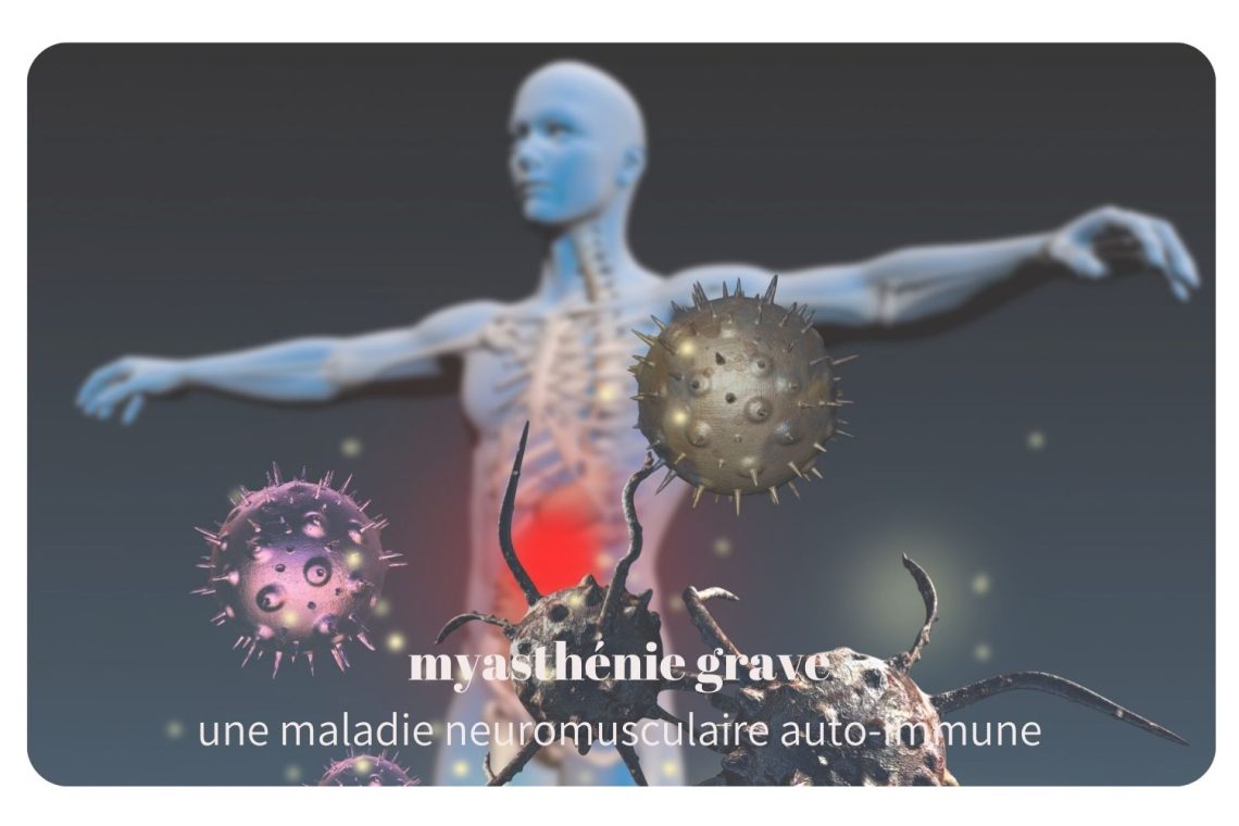 La myasthénie grave est une maladie auto-immune rare qui affecte la communication entre les nerfs et les muscles.