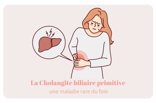 La cholangite biliaire primitive (CBP) est une maladie auto-immune rare qui affecte le foie, en provoquant une destruction progressive des petits canaux biliaires intra-hépatiques.