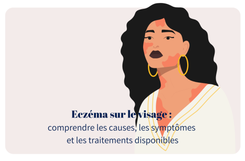 Eczéma sur le visage : comprendre les causes, les symptômes et les traitements disponibles