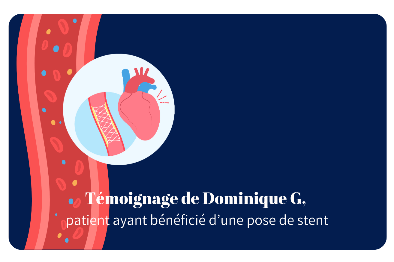 Santé cardiaque – Pose de stent : témoignage patient de Dominique G