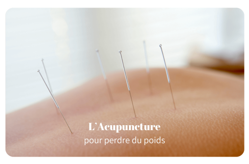 L'acupuncture pour perdre du poids