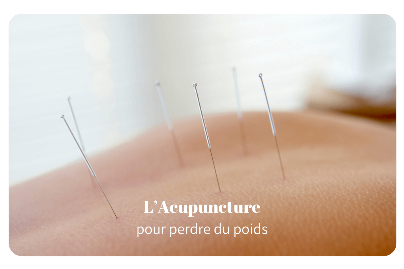 L&rsquo;acupuncture pour perdre du poids