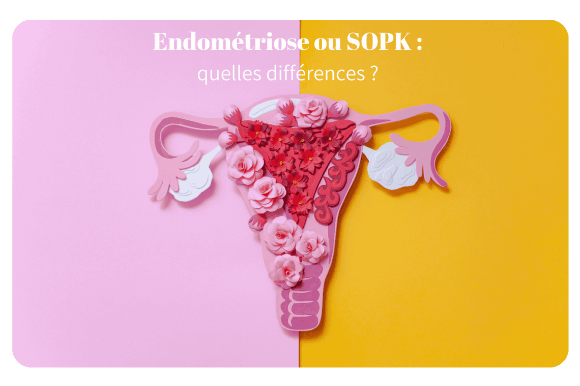 SOPK et endométriose sont deux maladies gynécologiques chroniques aux symptômes parfois similaires, mais aux causes et traitements bien différents. Cet article vous aide à mieux les distinguer pour poser un diagnostic précis et adopter la bonne prise en charge.