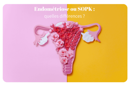 SOPK et endométriose sont deux maladies gynécologiques chroniques aux symptômes parfois similaires, mais aux causes et traitements bien différents. Cet article vous aide à mieux les distinguer pour poser un diagnostic précis et adopter la bonne prise en charge.