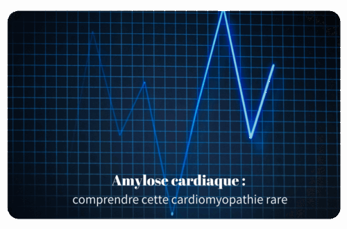 Amylose cardiaque : Amylose cardiaque : comprendre cette cardiomyopathie rare et traitements innovants