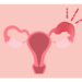 infection pelvienne