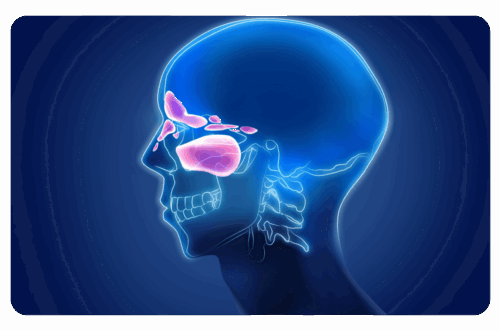 douleur sinusite vision radiologie