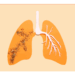 poumons abimés