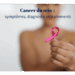 Le cancer du sein représente une prolifération anormale de cellules cancéreuses qui se développent au niveau du tissu mammaire. C'est le cancer le plus fréquent chez la femme avec près de 59 000 nouveaux cas diagnostiqués chaque année en France. Il touche principalement les femmes après 50 ans, mais peut également survenir chez des patientes plus jeunes et, plus rarement, chez les hommes (1% des cas).