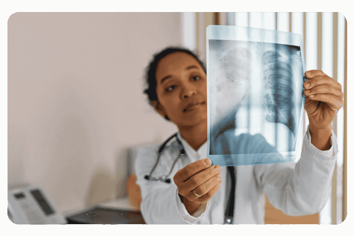 radiologie des poumons dans le cadre d'une pneumonie