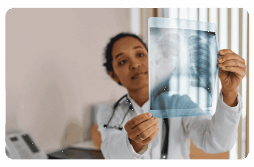 radiologie des poumons dans le cadre d'une pneumonie