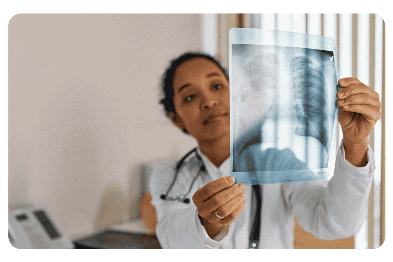 Pneumonie : Symptômes, Causes et Traitements