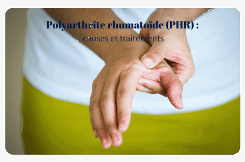 La polyarthrite rhumatoïde est un rhumatisme inflammatoire chronique qui se manifeste par des articulations gonflées et douloureuses et qui progresse par poussées. Les femmes sont deux à trois fois plus susceptibles de souffrir de cette maladie que les hommes, et elle atteint son apogée vers l'âge de 45 ans.