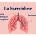 la sarcoidose