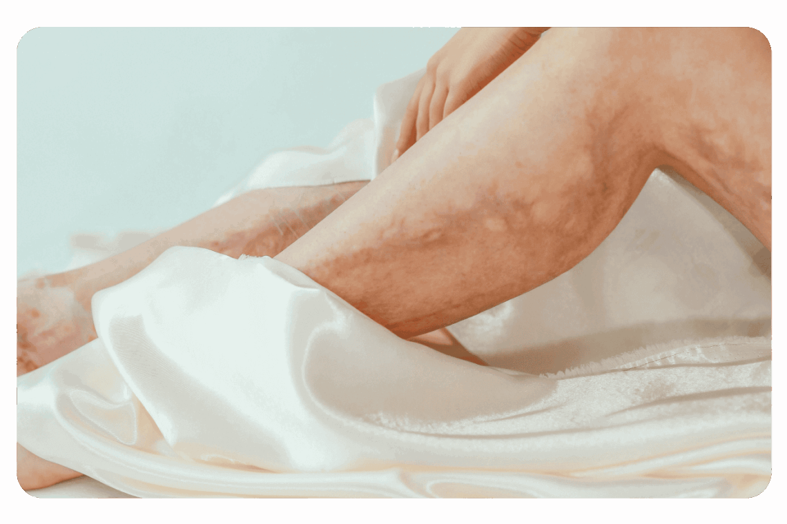 affections cutanées