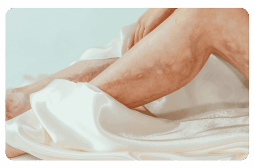 affections cutanées