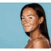 Vitiligo