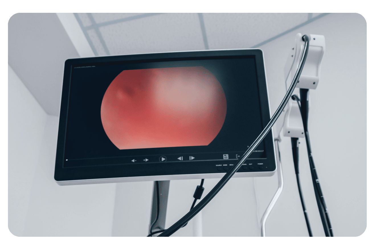 Différence entre coloscopie et endoscopie : guide complet des examens digestifs