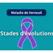 stades d'évolutions de la maladie de verneuil