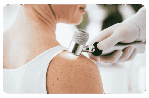 dermatoscope