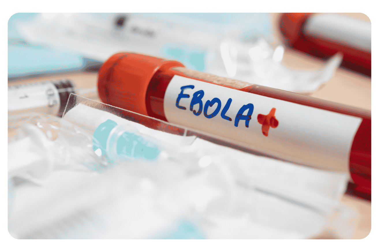Ebola en France en 2026 : ce qu’il faut savoir