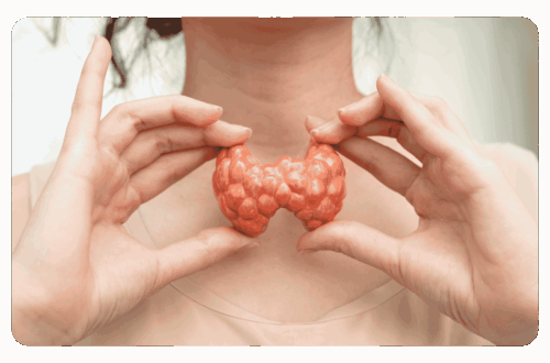 problème de thyroide