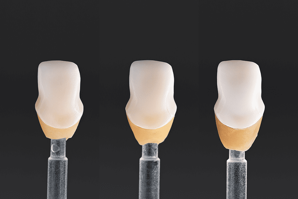 Sagemax NexxZr S High Strength Zirconia Blocks | DentaCarts | Dental Cart