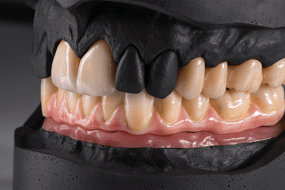 Sagemax NexxZr T Multi Zirconia Blocks | DentaCarts | Dental Cart