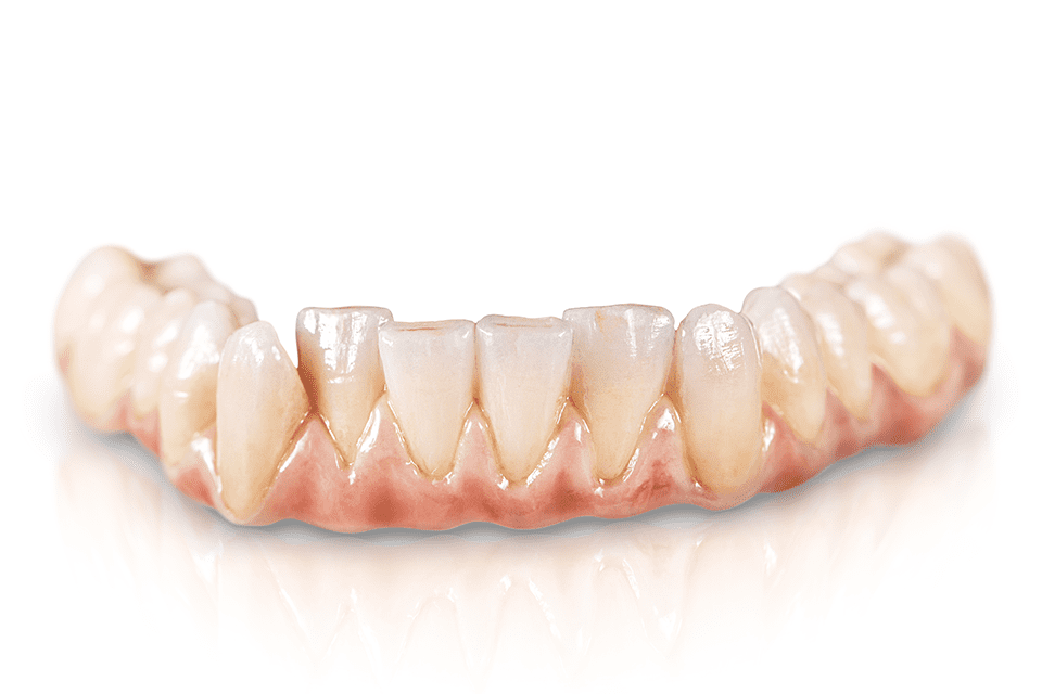 Sagemax NexxZr T Multi Zirconia Blocks | DentaCarts | Dental Cart